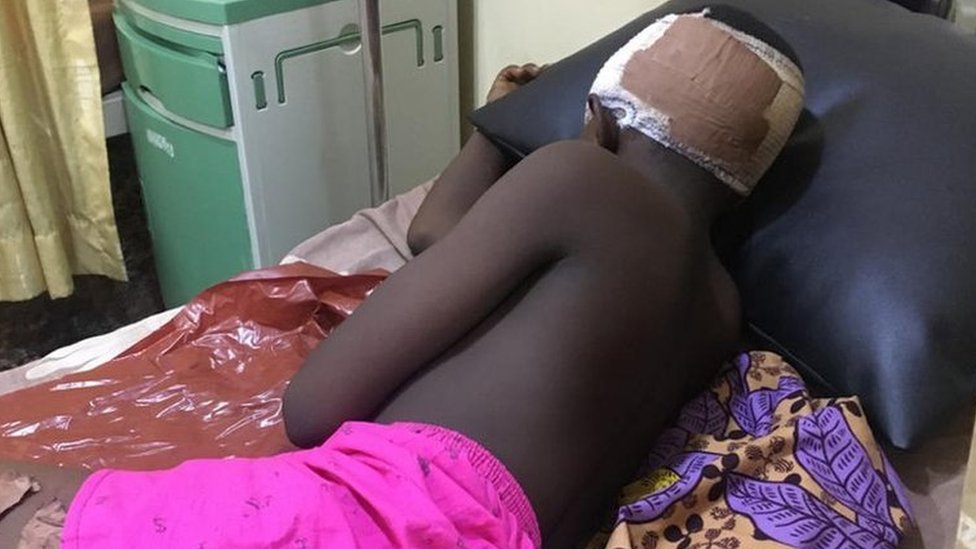 11-year-old Ayenajei Shekwoyiko dey battle for im life for Asokoro General hospital