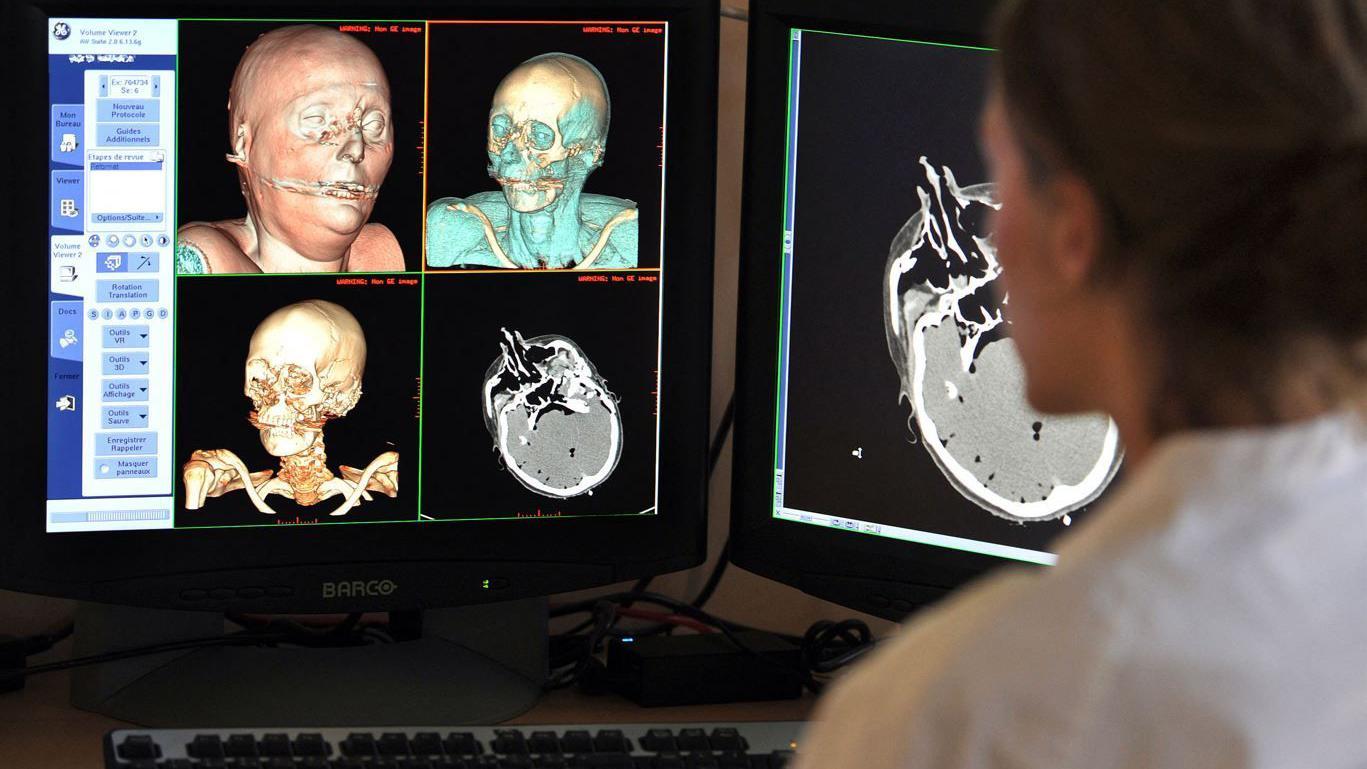 A doctor examining the images of a skull projected onto a computer screen 