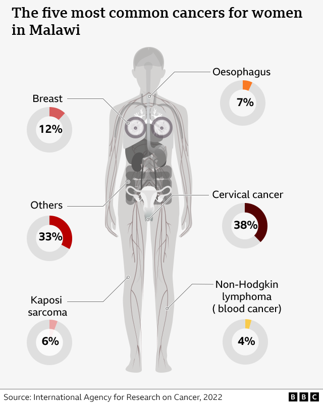 Diagram of a human body wey show di five most common cancers in women for Malawi. Cervical cancer na di most common, followed by breast, oesophagus, kaposi sarcoma and non-hodgkin lymphoma. 